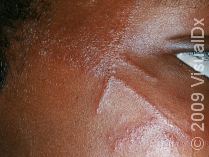 What does poison ivy look like?